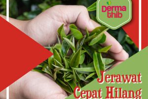 Agar Jerawat Cepat Hilang Gunakan Cara Alami Ini!